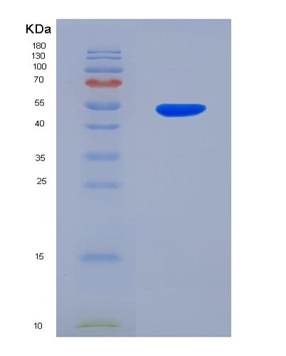 SDS-PAGE analysis of Human UPRT (Uracil Phosphoribosyltransferase Homolog) - Recombinant Protein, showing >95% purity under 15% SDS-PAGE (Reduced)