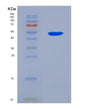 SDS-PAGE analysis of Human UPRT (Uracil Phosphoribosyltransferase Homolog) - Recombinant Protein, showing >95% purity under 15% SDS-PAGE (Reduced)