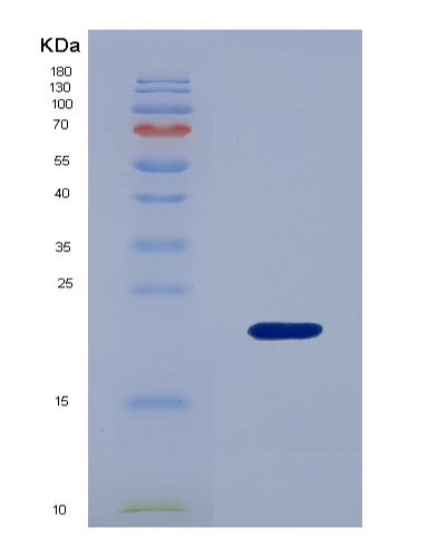 SDS-PAGE analysis of Human MDK (Midkine) - Recombinant Protein, showing >90% purity under 15% SDS-PAGE (Reduced)