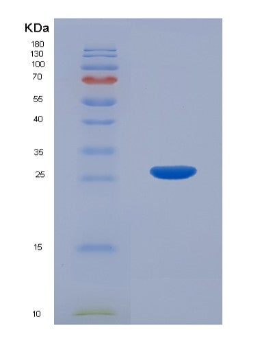 SDS-PAGE analysis of Human CTHRC1 (Collagen Triple Helix Repeat-Containing Protein 1) - Recombinant Protein, showing >95% purity under 15% SDS-PAGE (Reduced)