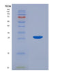 SDS-PAGE analysis of Human CTHRC1 (Collagen Triple Helix Repeat-Containing Protein 1) - Recombinant Protein, showing >95% purity under 15% SDS-PAGE (Reduced)