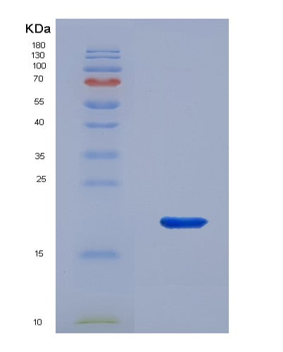 SDS-PAGE analysis of Human CNRIP1 (Cb1 Cannabinoid Receptor-Interacting Protein 1) - Recombinant Protein, showing >90% purity under 15% SDS-PAGE (Reduced)
