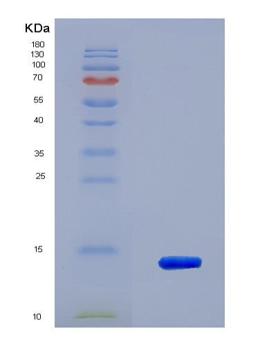 SDS-PAGE analysis of Human S100A16 (Protein S100-A16) - Recombinant Protein, showing >85% purity under 15% SDS-PAGE (Reduced)