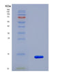 SDS-PAGE analysis of Human S100A16 (Protein S100-A16) - Recombinant Protein, showing >85% purity under 15% SDS-PAGE (Reduced)