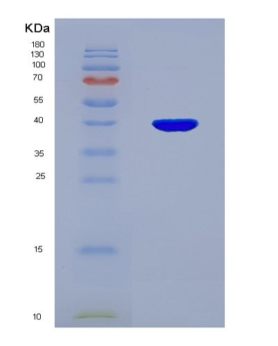 SDS-PAGE analysis of Human OTUB1 (Ubiquitin Thioesterase Otub1) - Recombinant Protein, showing >85% purity under 15% SDS-PAGE (Reduced)