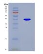 SDS-PAGE analysis of Human OTUB1 (Ubiquitin Thioesterase Otub1) - Recombinant Protein, showing >85% purity under 15% SDS-PAGE (Reduced)