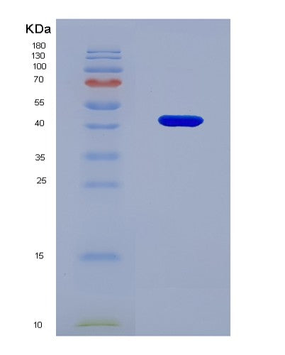 SDS-PAGE analysis of Human ACVR2A (Activin Receptor Type-2A) - Recombinant Protein, showing >90% purity under 15% SDS-PAGE (Reduced)