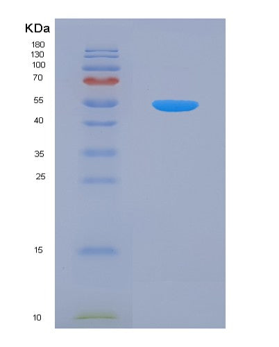 SDS-PAGE analysis of Human MARS2 (Methionine--Trna Ligase, Mitochondrial) - Recombinant Protein, showing >90% purity under 15% SDS-PAGE (Reduced)