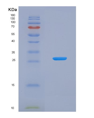SDS-PAGE analysis of Human BMF (Bcl-2-Modifying Factor) - Recombinant Protein, showing >85% purity under 15% SDS-PAGE (Reduced)
