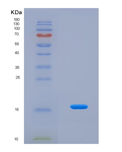 SDS-PAGE analysis of Mouse Acan (Aggrecan Core Protein) - Recombinant Protein, showing >90% purity under 15% SDS-PAGE (Reduced)