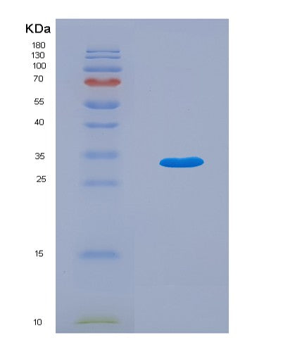 SDS-PAGE analysis of Human OGA (Protein O-Glcnacase) - Recombinant Protein, showing >90% purity under 15% SDS-PAGE (Reduced)