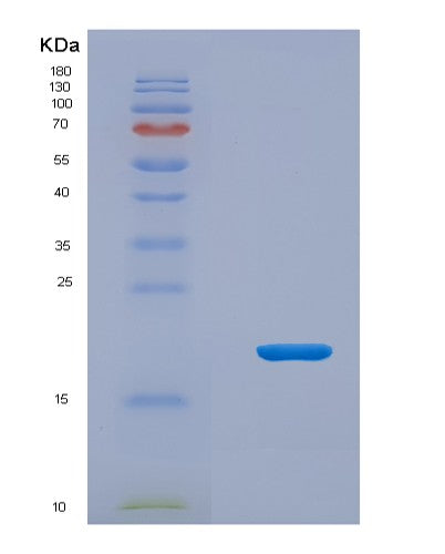 SDS-PAGE analysis of Human MCEE (Methylmalonyl-Coa Epimerase, Mitochondrial) - Recombinant Protein, showing >85% purity under 15% SDS-PAGE (Reduced)
