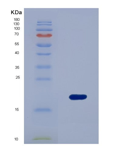 SDS-PAGE analysis of Human AMELX (Amelogenin, X Isoform) - Recombinant Protein, showing >95% purity under 15% SDS-PAGE (Reduced)