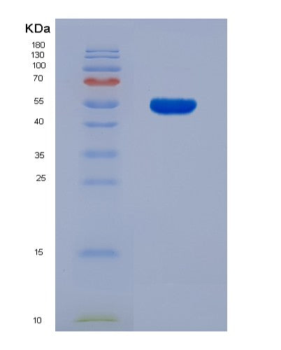 SDS-PAGE analysis of Mouse Prl (Prolactin) - Recombinant Protein, showing >90% purity under 15% SDS-PAGE (Reduced)