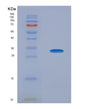 SDS-PAGE analysis of Human CEACAM1 (Cell Adhesion Molecule Ceacam1) - Recombinant Protein, showing >90% purity under 15% SDS-PAGE (Reduced)