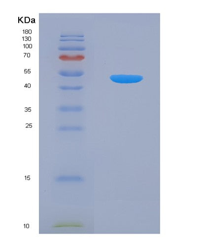 SDS-PAGE analysis of Human APP (Amyloid-Beta Precursor Protein) - Recombinant Protein, showing >95% purity under 15% SDS-PAGE (Reduced)