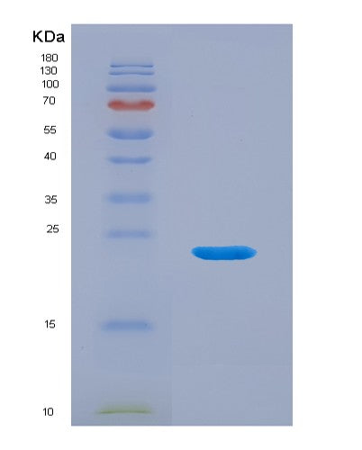 SDS-PAGE analysis of Mouse Mmp12 (Macrophage Metalloelastase) - Recombinant Protein, showing >90% purity under 15% SDS-PAGE (Reduced)