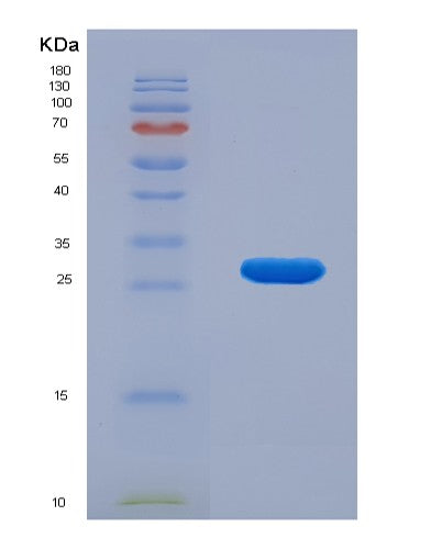 SDS-PAGE analysis of Human HSPG2 (Basement Membrane-Specific Heparan Sulfate Proteoglycan Core Protein) - Recombinant Protein, showing >90% purity under 15% SDS-PAGE (Reduced)