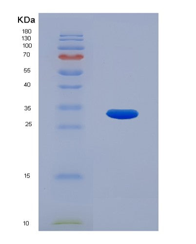 SDS-PAGE analysis of Human CNN2 (Calponin-2) - Recombinant Protein, showing >90% purity under 15% SDS-PAGE (Reduced)