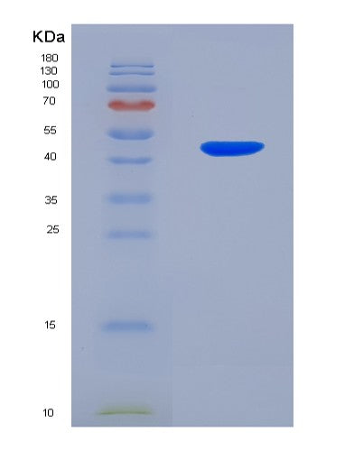 SDS-PAGE analysis of Human PAFAH2 (Platelet-Activating Factor Acetylhydrolase 2, Cytoplasmic) - Recombinant Protein, showing >95% purity under 15% SDS-PAGE (Reduced)
