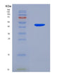 SDS-PAGE analysis of Human PAFAH2 (Platelet-Activating Factor Acetylhydrolase 2, Cytoplasmic) - Recombinant Protein, showing >95% purity under 15% SDS-PAGE (Reduced)