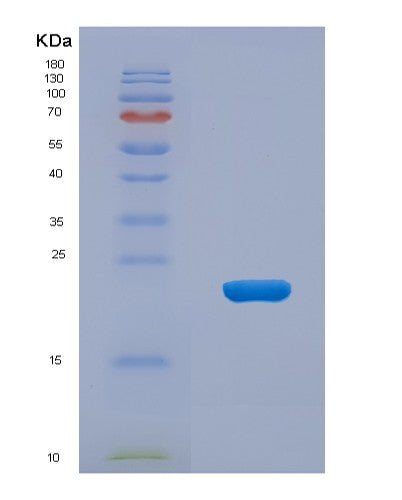 SDS-PAGE analysis of Human PARK7 (Parkinson Disease Protein 7) - Recombinant Protein, CAT# BLT-08374P showing >85% purity under 15% SDS-PAGE (Reduced)