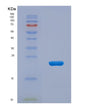 SDS-PAGE analysis of Human PARK7 (Parkinson Disease Protein 7) - Recombinant Protein, CAT# BLT-08374P showing >85% purity under 15% SDS-PAGE (Reduced)