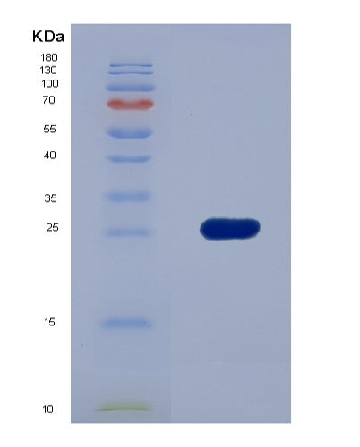 SDS-PAGE analysis of Human PLIN2 (Perilipin-2) - Recombinant Protein, showing >85% purity under 15% SDS-PAGE (Reduced)