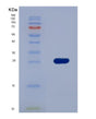 SDS-PAGE analysis of Human PLIN2 (Perilipin-2) - Recombinant Protein, showing >85% purity under 15% SDS-PAGE (Reduced)