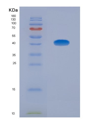 SDS-PAGE analysis of Human CCL13 (C-C Motif Chemokine 13) - Recombinant Protein, showing >85% purity under 15% SDS-PAGE (Reduced)