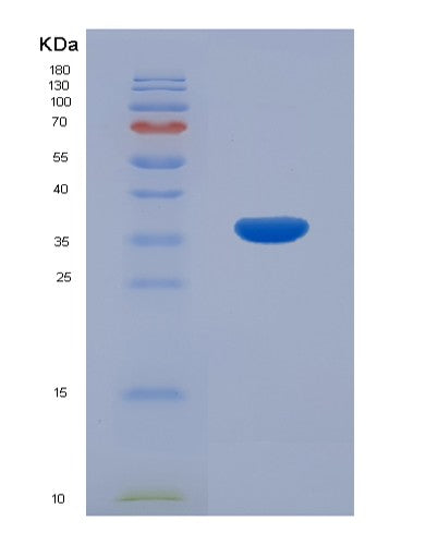 SDS-PAGE analysis of Human MGLL (Monoglyceride Lipase) - Recombinant Protein, showing >95% purity under 15% SDS-PAGE (Reduced)