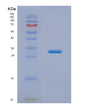 SDS-PAGE analysis of Human OLFM1 (Noelin) - Recombinant Protein, showing >85% purity under 15% SDS-PAGE (Reduced)