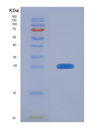 SDS-PAGE analysis of Human CIB1 (Calcium And Integrin-Binding Protein 1) - Recombinant Protein, showing >85% purity under 15% SDS-PAGE (Reduced)