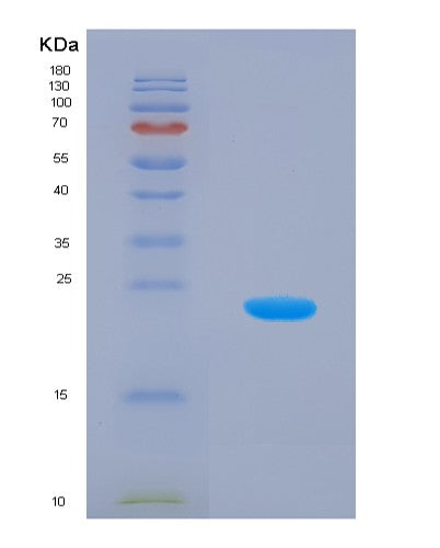 SDS-PAGE analysis of Mouse Park7 (Parkinson Disease Protein 7 Homolog) - Recombinant Protein, showing >95% purity under 15% SDS-PAGE (Reduced)