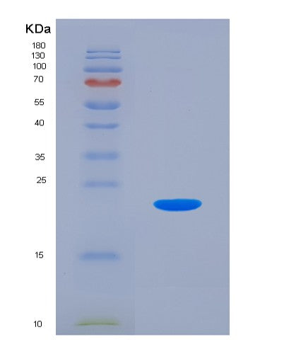 SDS-PAGE analysis of Human HSPB9 (Heat Shock Protein Beta-9) - Recombinant Protein, showing >85% purity under 15% SDS-PAGE (Reduced)