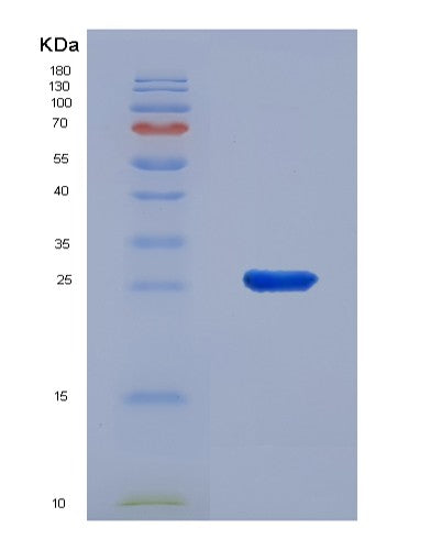 SDS-PAGE analysis of Human LXN (Latexin) - Recombinant Protein, showing >85% purity under 15% SDS-PAGE (Reduced)