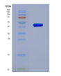 SDS-PAGE analysis of Human VAMP8 (Vesicle-Associated Membrane Protein 8) - Recombinant Protein, showing >90% purity under 15% SDS-PAGE (Reduced)