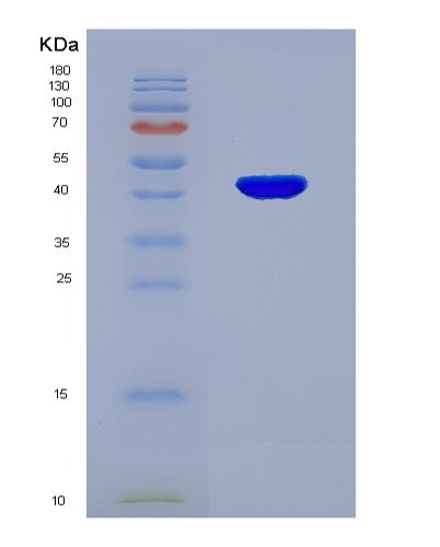 SDS-PAGE analysis of Human ACAT2 (Acetyl-Coa Acetyltransferase, Cytosolic) - Recombinant Protein, showing >95% purity under 15% SDS-PAGE (Reduced)