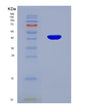 SDS-PAGE analysis of Human ACAT2 (Acetyl-Coa Acetyltransferase, Cytosolic) - Recombinant Protein, showing >95% purity under 15% SDS-PAGE (Reduced)