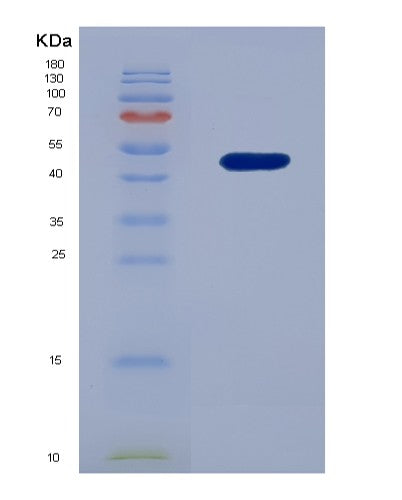 SDS-PAGE analysis of Human MCM5 (Dna Replication Licensing Factor Mcm5) - Recombinant Protein, showing >90% purity under 15% SDS-PAGE (Reduced)