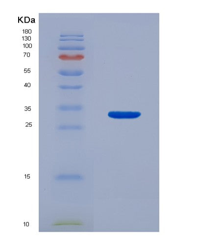 SDS-PAGE analysis of Human CDC6 (Cell Division Control Protein 6 Homolog) - Recombinant Protein, showing >90% purity under 15% SDS-PAGE (Reduced)