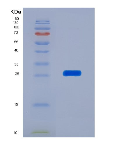 SDS-PAGE analysis of Human ITPA (Inosine Triphosphate Pyrophosphatase) - Recombinant Protein, showing >85% purity under 15% SDS-PAGE (Reduced)