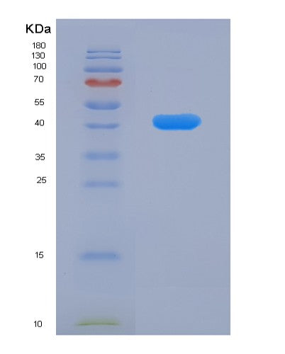 SDS-PAGE analysis of Human HDAC8 (Histone Deacetylase 8) - Recombinant Protein, showing >85% purity under 15% SDS-PAGE (Reduced)