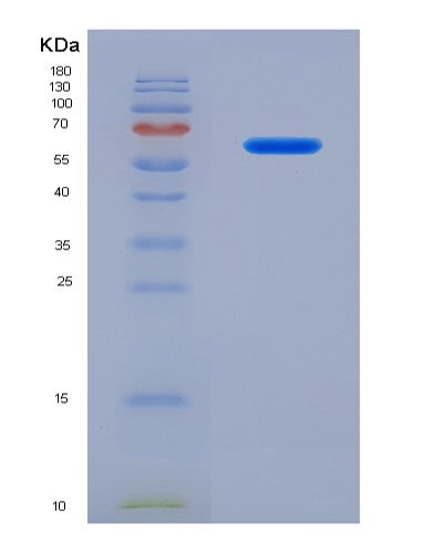 SDS-PAGE analysis of Human CADM1 (Cell Adhesion Molecule 1) - Recombinant Protein, showing >90% purity under 15% SDS-PAGE (Reduced)