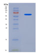 SDS-PAGE analysis of Human CADM1 (Cell Adhesion Molecule 1) - Recombinant Protein, showing >90% purity under 15% SDS-PAGE (Reduced)