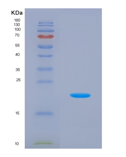SDS-PAGE analysis of Human MRPL1 (Large Ribosomal Subunit Protein Ul1M) - Recombinant Protein, showing >95% purity under 15% SDS-PAGE (Reduced)