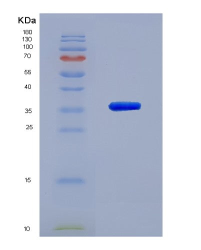 SDS-PAGE analysis of Human TRIM5 (Tripartite Motif-Containing Protein 5) - Recombinant Protein, showing >95% purity under 15% SDS-PAGE (Reduced)