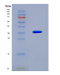 SDS-PAGE analysis of Human TRIM5 (Tripartite Motif-Containing Protein 5) - Recombinant Protein, showing >95% purity under 15% SDS-PAGE (Reduced)