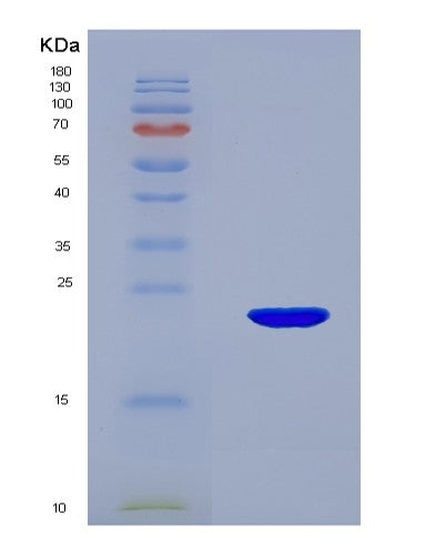 SDS-PAGE analysis of Mouse Glo1 (Lactoylglutathione Lyase) - Recombinant Protein, showing >95% purity under 15% SDS-PAGE (Reduced)