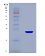 SDS-PAGE analysis of Mouse Glo1 (Lactoylglutathione Lyase) - Recombinant Protein, showing >95% purity under 15% SDS-PAGE (Reduced)